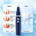 Vtiisamao Pet Dental Scaler — At-Home Tartar Remover for Cats & Dogs