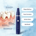 Vtiisamao Pet Dental Scaler Lite — One-Button Tartar Remover for Cats & Dogs