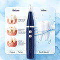 Vtiisamao Electric Plaque Remover for Teeth at home (ORAL Lite) - One-Button Dental Cleaner