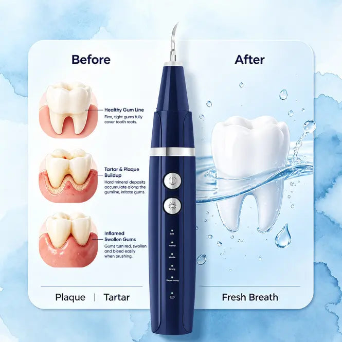 Vtiisamao Electric Plaque Remover for Teeth at home (ORAL Lite) - One-Button Dental Cleaner