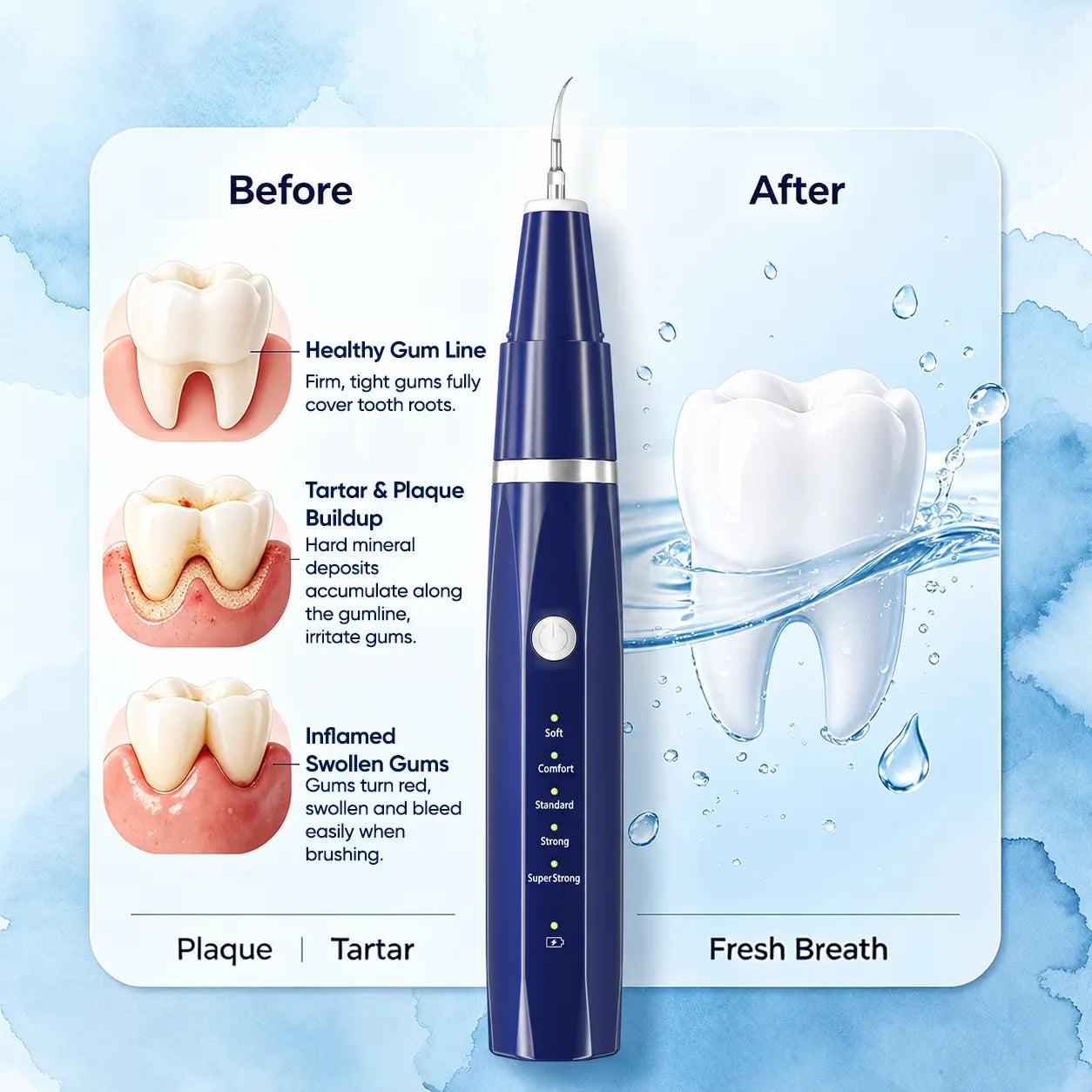 Vtiisamao Electric Plaque Remover for Teeth at home (ORAL Lite) - One-Button Dental Cleaner