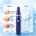 Vtiisamao Pet Dental Scaler Lite — One-Button Tartar Remover for Cats & Dogs