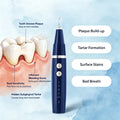 Vtiisamao Pet Dental Scaler — At-Home Tartar Remover for Cats & Dogs