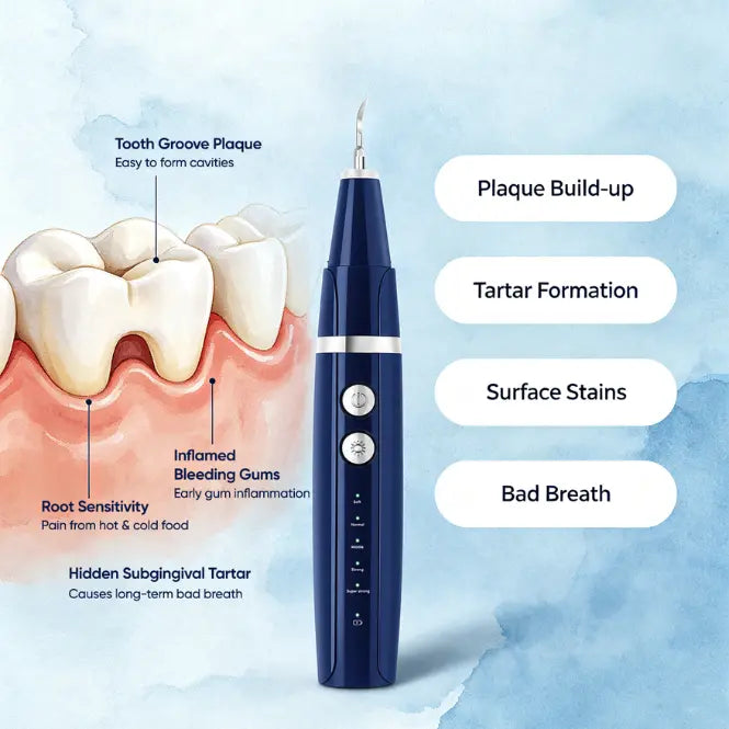 Vtiisamao Pet Dental Scaler — At-Home Tartar Remover for Cats & Dogs