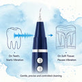 Vtiisamao Pet Dental Scaler — At-Home Tartar Remover for Cats & Dogs