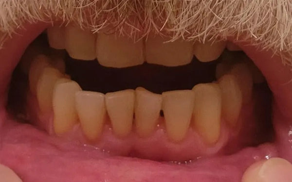 After