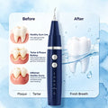 Vtiisamao ultrasonic tartar remover for teeth, an electric dental scaler designed for removing plaque and dental calculus buildup at home. Product image showing tartar removal comparison before and after cleaning.