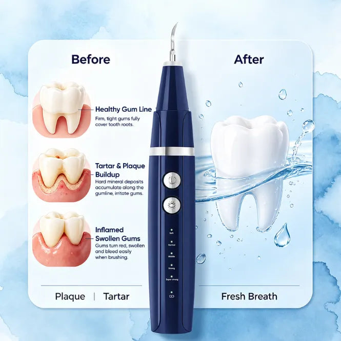 Vtiisamao ultrasonic tartar remover for teeth, an electric dental scaler designed for removing plaque and dental calculus buildup at home. Product image showing tartar removal comparison before and after cleaning.