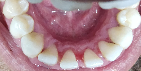 After