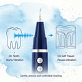 Rechargeable electric dental scaler with smart vibration control technology for precise tartar and plaque removal